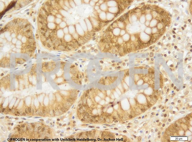 TIP47/PLIN3 Antibody in Immunohistochemistry (IHC)