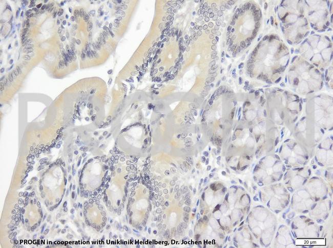 TIP47/PLIN3 Antibody in Immunohistochemistry (IHC)