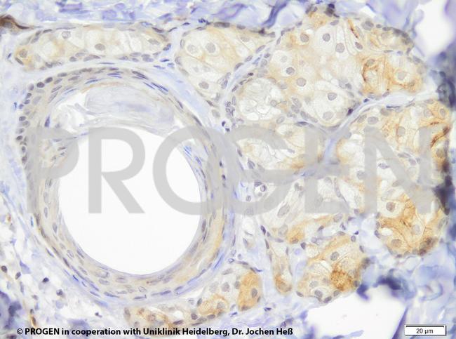 TIP47/PLIN3 Antibody in Immunohistochemistry (IHC)