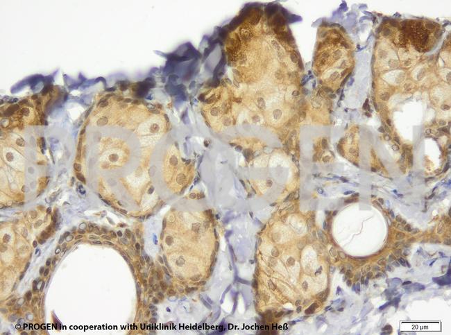 TIP47/PLIN3 Antibody in Immunohistochemistry (IHC)