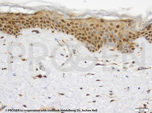 TIP47/PLIN3 Antibody in Immunohistochemistry (IHC)