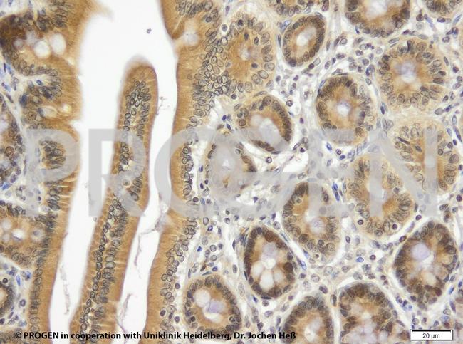 TIP47/PLIN3 Antibody in Immunohistochemistry (IHC)