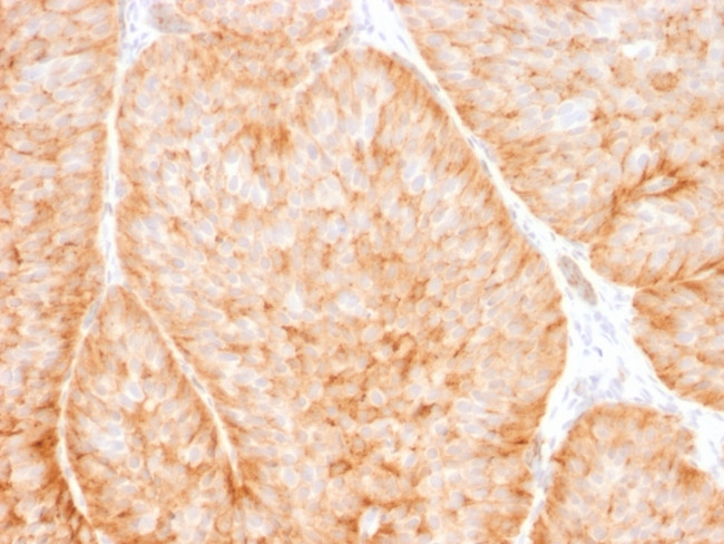 GLUT-1 Antibody in Immunohistochemistry (Paraffin) (IHC (P))