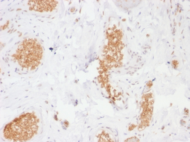 GLUT-1 Antibody in Immunohistochemistry (Paraffin) (IHC (P))