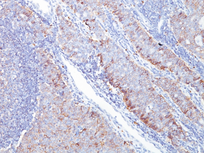 GLUT-1 Antibody in Immunohistochemistry (Paraffin) (IHC (P))