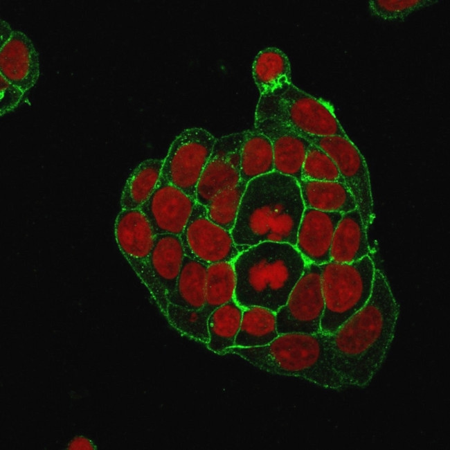 GLUT-1 Antibody in Immunocytochemistry (ICC/IF)