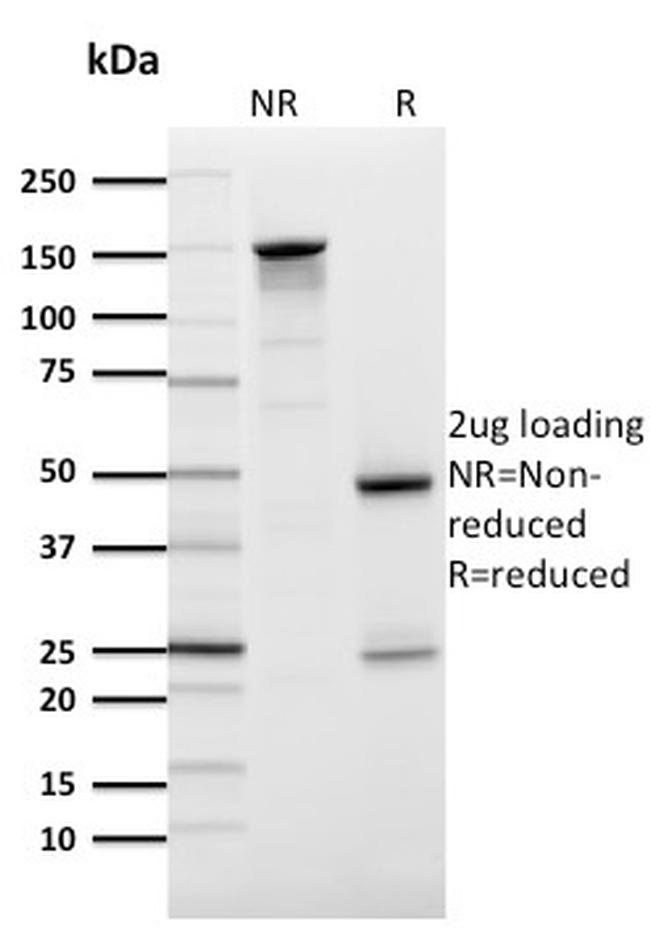 GLUT-1 Antibody in SDS-PAGE (SDS-PAGE)