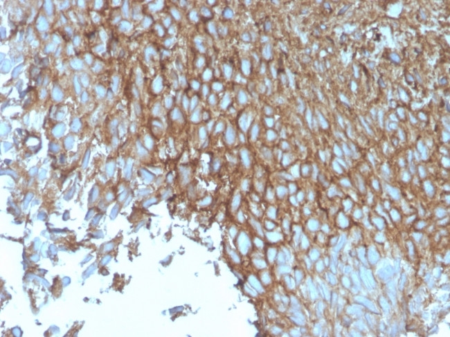 GLUT-1 (Tumor Progression and Mesothelioma Marker) Antibody in Immunohistochemistry (Paraffin) (IHC (P))