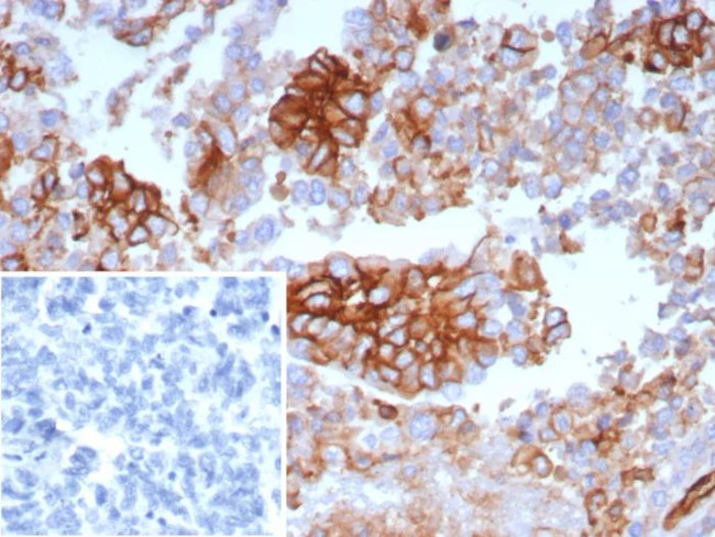 GLUT-1 (Tumor Progression and Mesothelioma Marker) Antibody in Immunohistochemistry (Paraffin) (IHC (P))