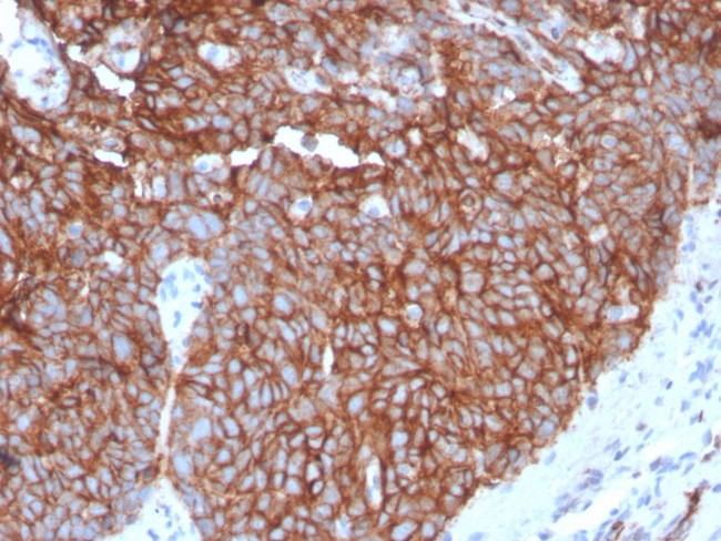 GLUT-1 Antibody in Immunohistochemistry (Paraffin) (IHC (P))