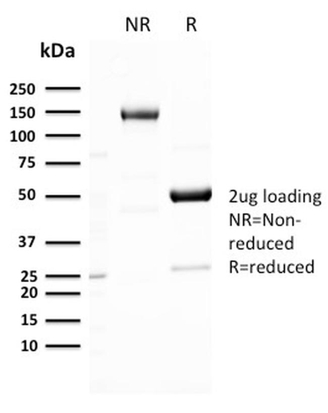 GLUT-1 Antibody in SDS-PAGE (SDS-PAGE)