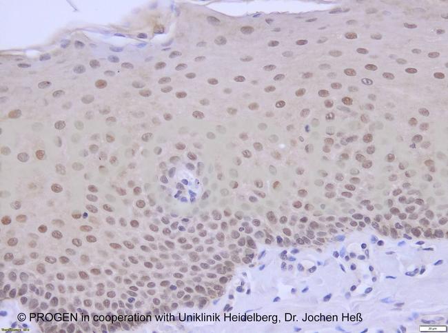 Plakophilin 1 Antibody in Immunohistochemistry (IHC)