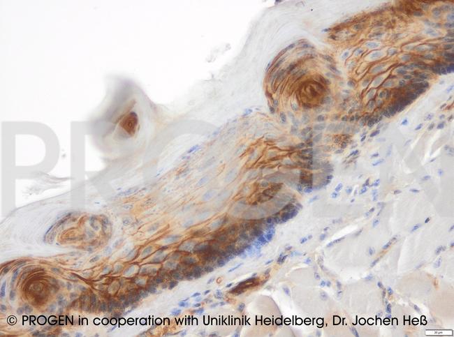 Plakophilin 1 Antibody in Immunohistochemistry (IHC)