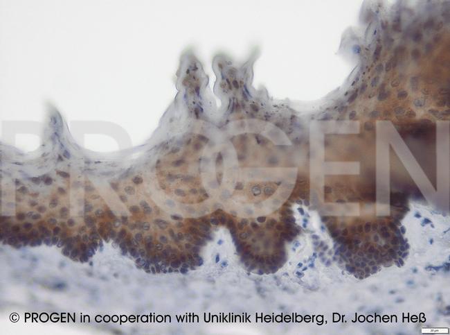 Plakophilin 1 Antibody in Immunohistochemistry (IHC)