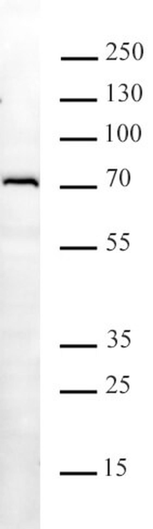 METTL3 Antibody in Western Blot (WB)