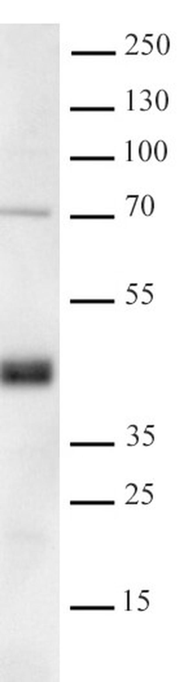 Bcl7A Antibody in Western Blot (WB)