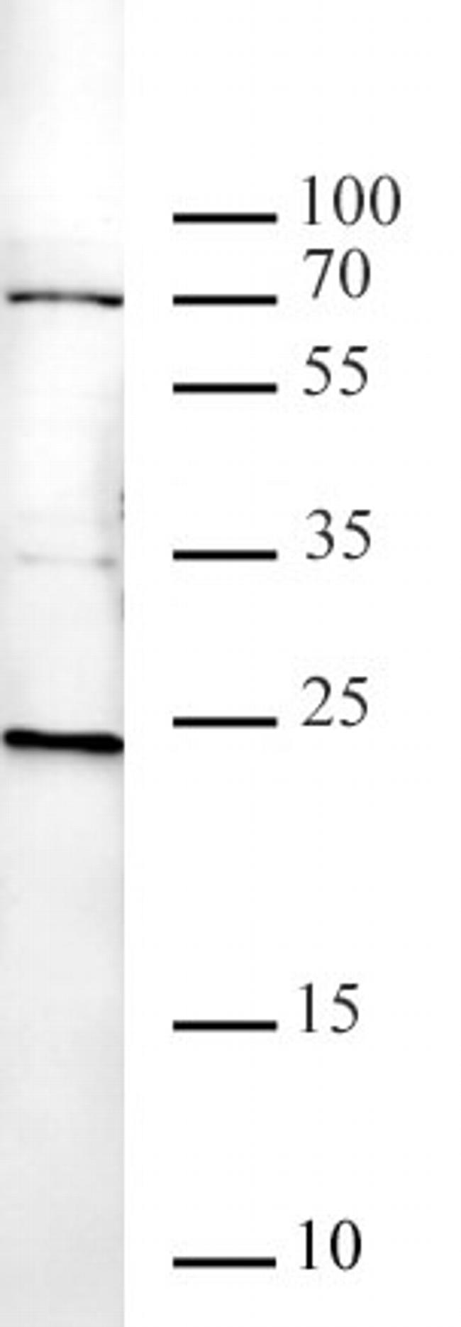 Histone H2AK119ub Antibody in Western Blot (WB)