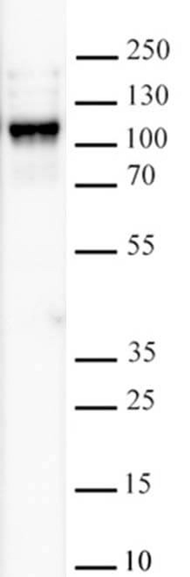 KDM2B Antibody in Western Blot (WB)