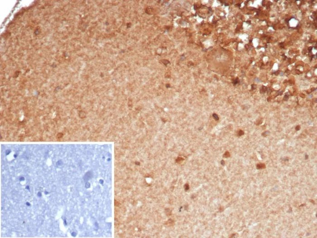 SLC18A2 Antibody in Immunohistochemistry (Paraffin) (IHC (P))
