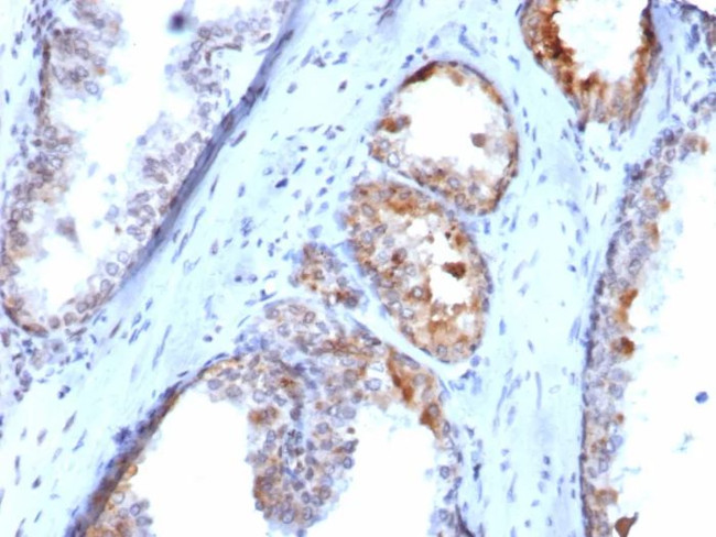 SLC18A2 Antibody in Immunohistochemistry (Paraffin) (IHC (P))