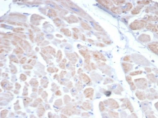 Somatostatin receptor type 2 (SS2R)/SSTR2 Antibody in Immunohistochemistry (Paraffin) (IHC (P))