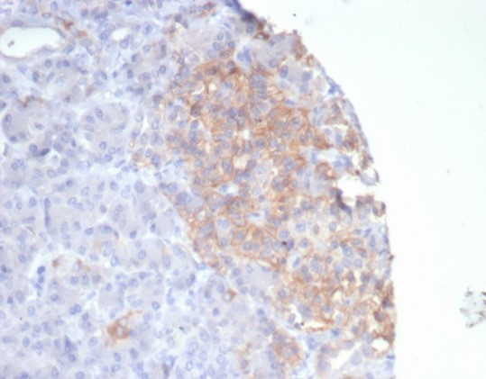 Somatostatin receptor type 2 (SS2R)/SSTR2 Antibody in Immunohistochemistry (Paraffin) (IHC (P))