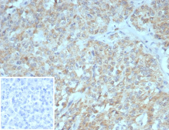 Somatostatin receptor type 2 (SS2R)/SSTR2 Antibody in Immunohistochemistry (Paraffin) (IHC (P))