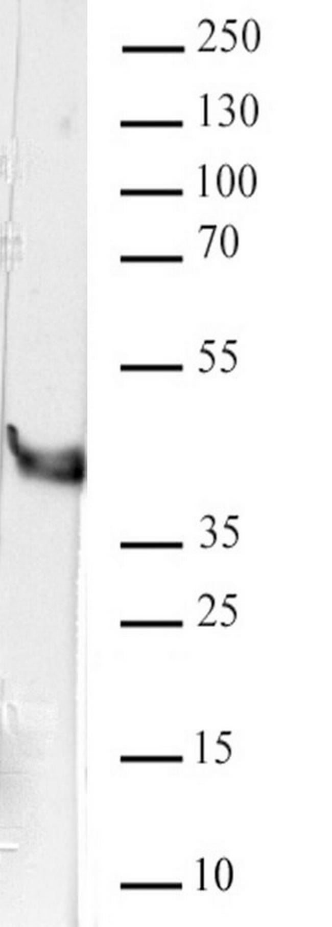 hnRNP A2B1 Antibody in Western Blot (WB)