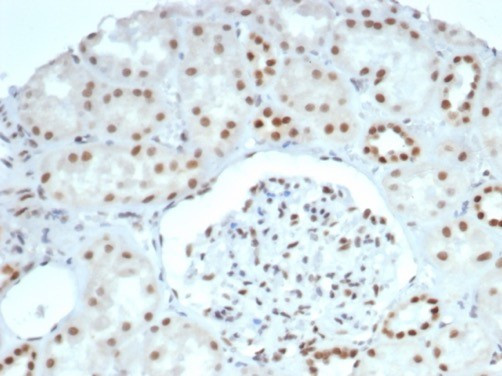 BRG1/SMARCA4 Antibody in Immunohistochemistry (Paraffin) (IHC (P))