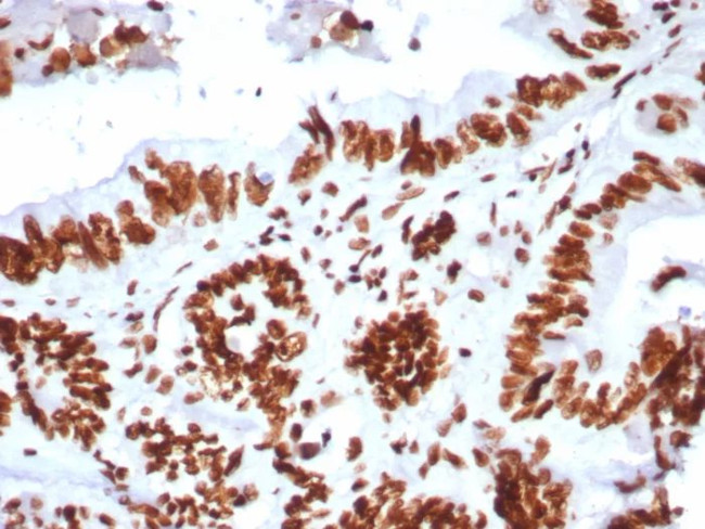 BRG1/SMARCA4 Antibody in Immunohistochemistry (Paraffin) (IHC (P))