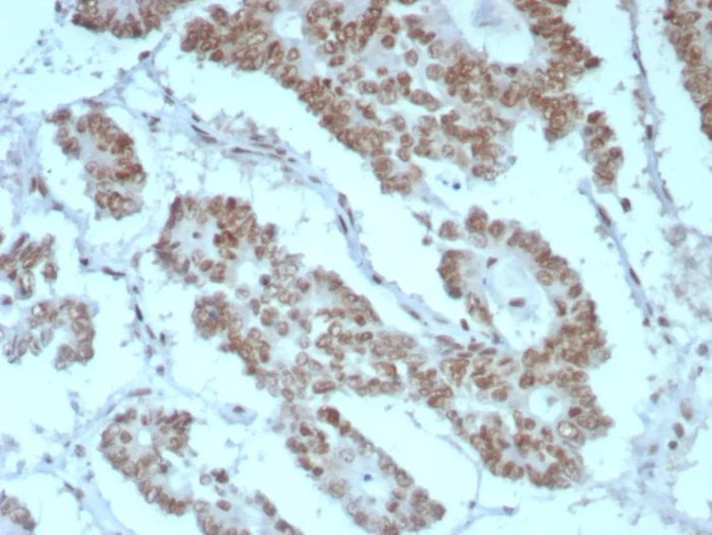 Integrase interactor 1 (INI-1)/SNF5/SMARCB1 Antibody in Immunohistochemistry (Paraffin) (IHC (P))