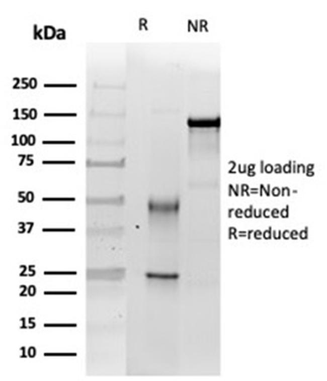 Integrase interactor 1 (INI-1)/SNF5/SMARCB1 Antibody in Immunoelectrophoresis (IE)