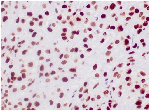 Integrase interactor 1 (INI-1)/SNF5/SMARCB1 Antibody in Immunohistochemistry (Paraffin) (IHC (P))