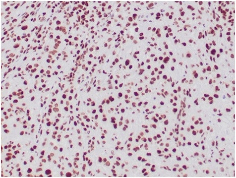 Integrase interactor 1 (INI-1)/SNF5/SMARCB1 Antibody in Immunohistochemistry (Paraffin) (IHC (P))