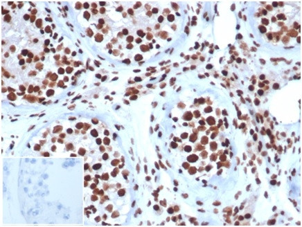 Integrase interactor 1 (INI-1)/SNF5/SMARCB1 Antibody in Immunohistochemistry (Paraffin) (IHC (P))