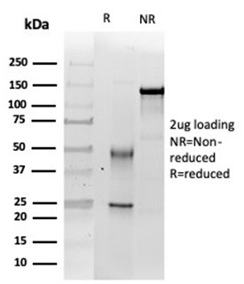 Integrase interactor 1 (INI-1)/SNF5/SMARCB1 Antibody in SDS-PAGE (SDS-PAGE)