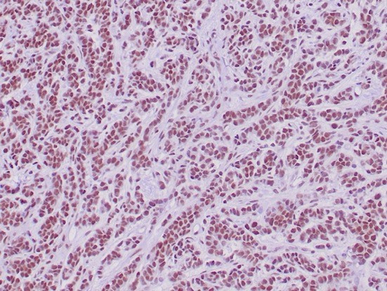 Integrase interactor 1 (INI-1)/SNF5/SMARCB1 Antibody in Immunohistochemistry (Paraffin) (IHC (P))