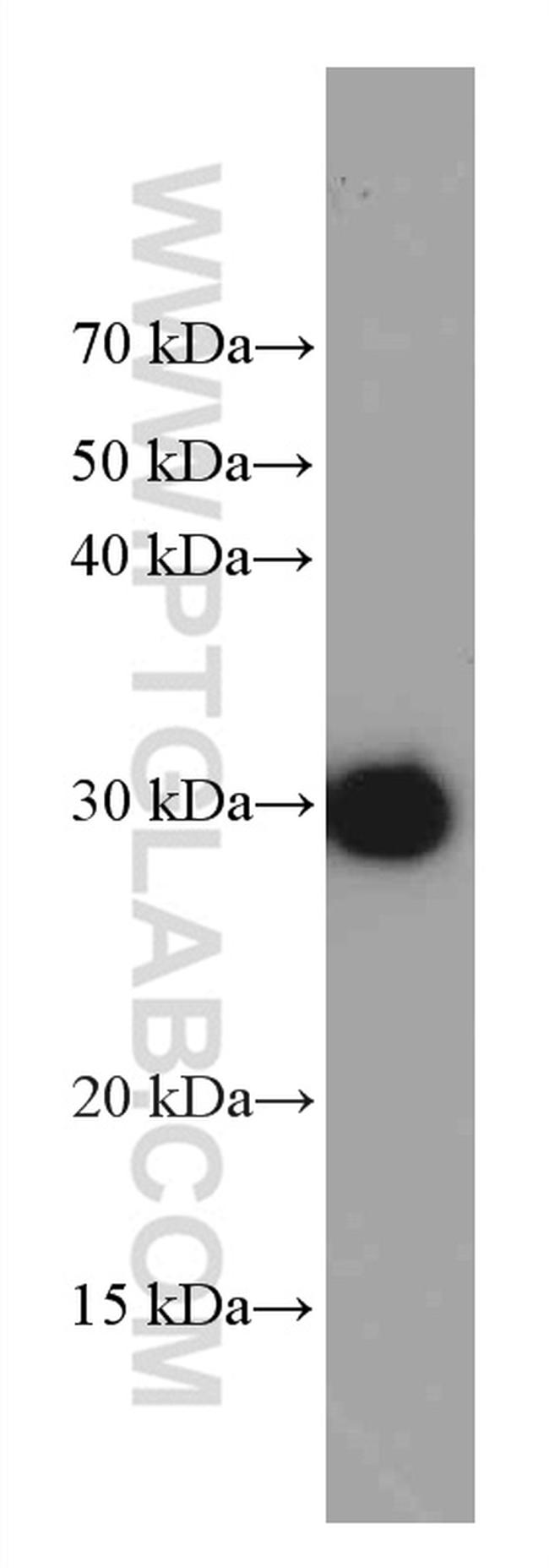 GST Tag Antibody in Western Blot (WB)