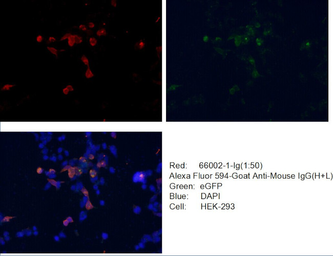 GFP tag Antibody in Immunocytochemistry (ICC/IF)