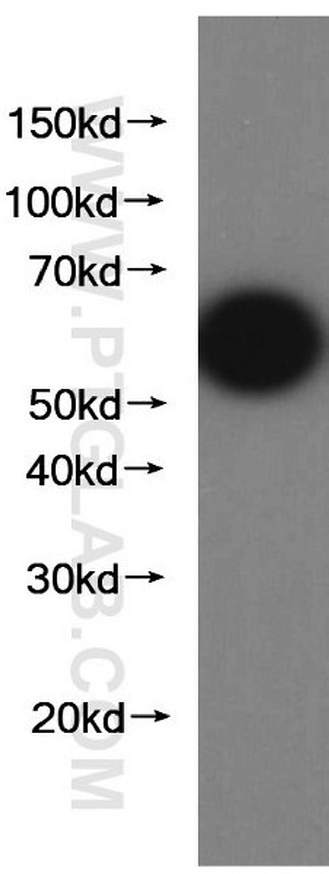 GFP tag Antibody in Western Blot (WB)