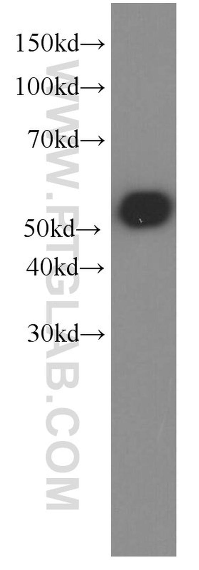 GFP tag Antibody in Western Blot (WB)