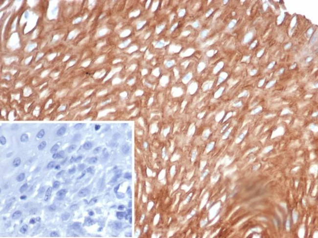 SI-CLP/Chitinase Domain Containing 1 (CHID1) Antibody in Immunohistochemistry (Paraffin) (IHC (P))