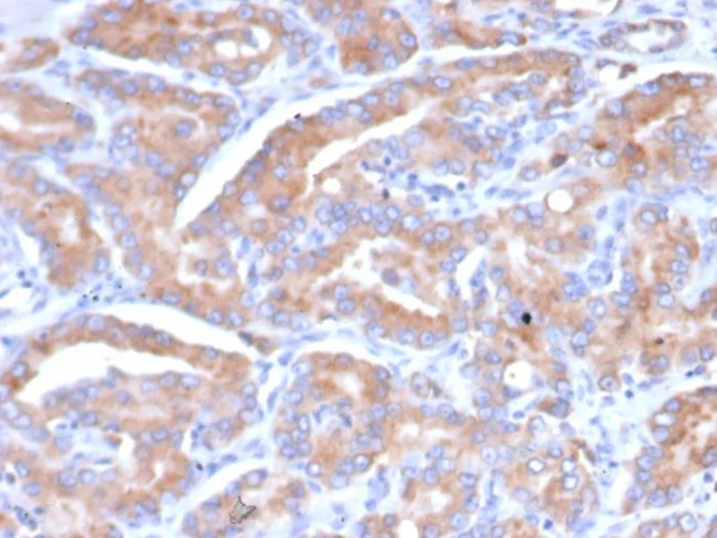 SI-CLP/Chitinase Domain Containing 1 (CHID1) Antibody in Immunohistochemistry (Paraffin) (IHC (P))