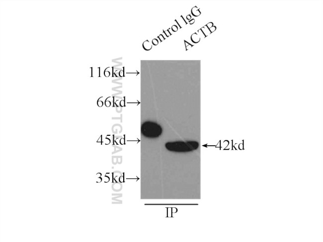 beta Actin Antibody in Immunoprecipitation (IP)