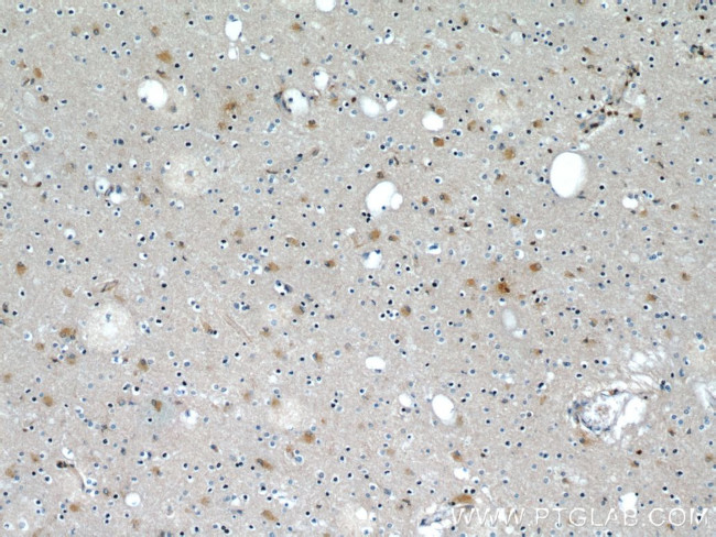 beta Actin Antibody in Immunohistochemistry (Paraffin) (IHC (P))