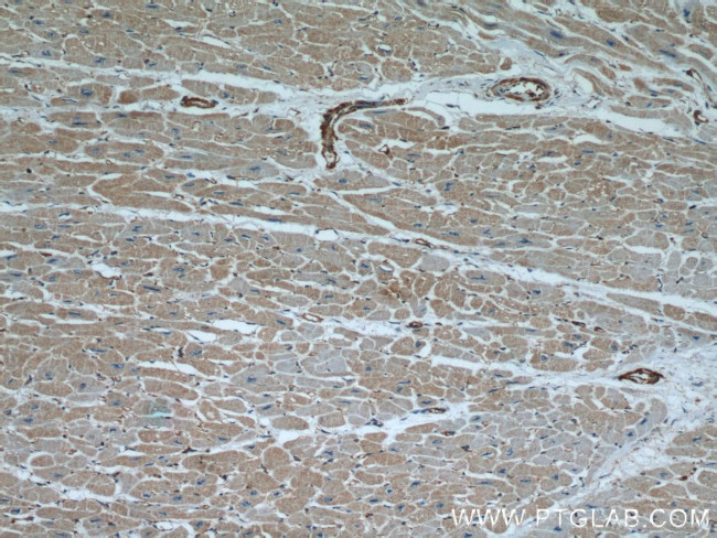 beta Actin Antibody in Immunohistochemistry (Paraffin) (IHC (P))