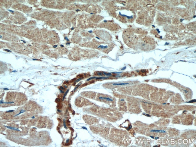 beta Actin Antibody in Immunohistochemistry (Paraffin) (IHC (P))