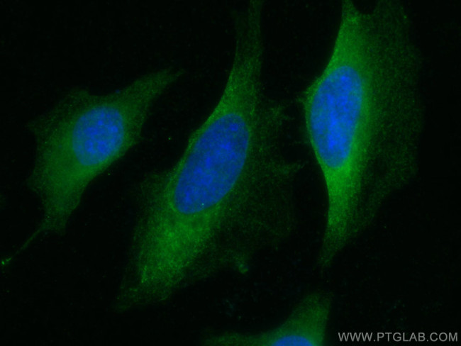 SEC5/EXOC2 Antibody in Immunocytochemistry (ICC/IF)