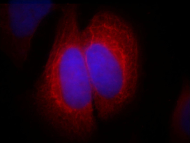 SEC5/EXOC2 Antibody in Immunocytochemistry (ICC/IF)