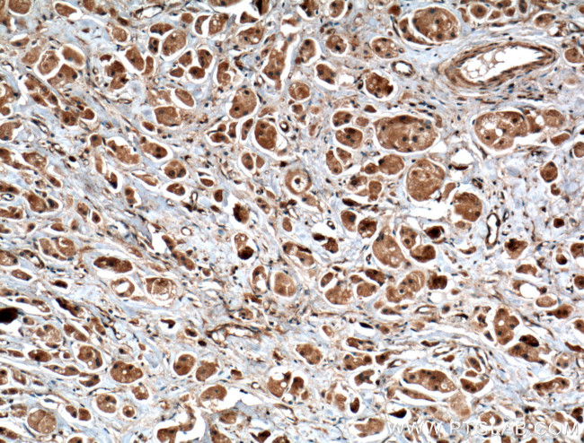 SEC5/EXOC2 Antibody in Immunohistochemistry (Paraffin) (IHC (P))